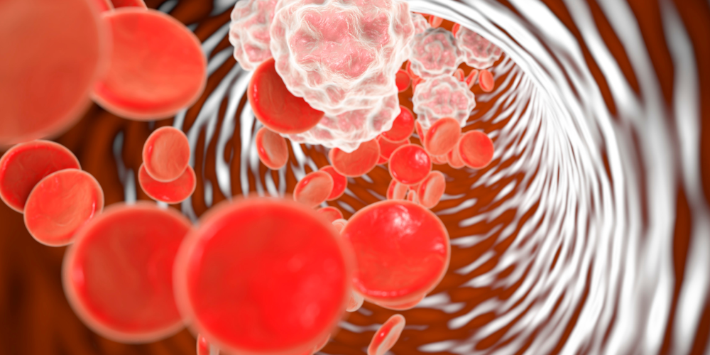 Understanding inflammation in bodybuilding