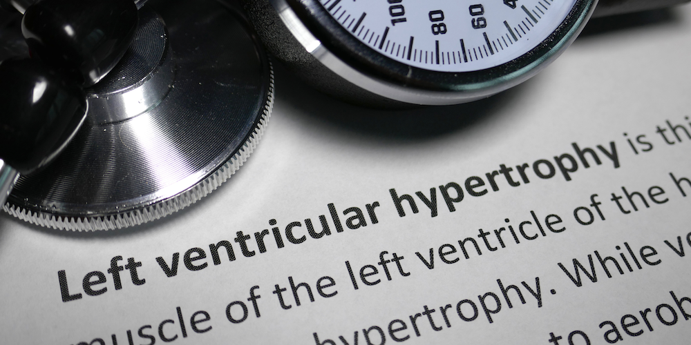 Left ventricular hypertrophy (LVH) in bodybuilding